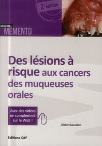 Des lésions à risque aux cancers des muqueuses orales
