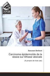 Carcinome epidermoïde de la vessie sur lithiase vesicale : (A propos de trois cas)