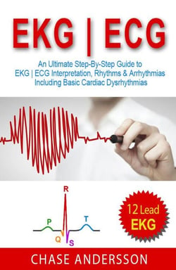 EKG | ECG: An Ultimate Step-By-Step Guide to 12-Lead EKG | ECG Interpretation, Rhythms &amp; Arrhythmias Including Basic Cardiac Dysrhythmias