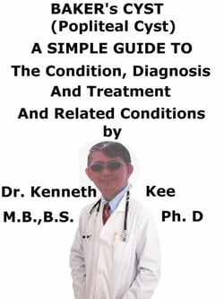 Baker’s Cyst, (Popliteal Cyst)  A  Simple  Guide  To  The Condition, Diagnosis, Treatment  And  Related Conditions