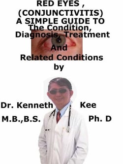 Red Eyes (Conjunctivitis), A  Simple  Guide  To  The Condition, Diagnosis, Treatment  And  Related Conditions