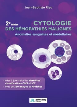 Cytologie des hémopathies malignes (2e édition) - Anomalies sanguines et médullaires