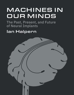 Machines in Our Minds - The Past, Present, and Future of Neural Implants