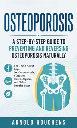 Osteoporosis: A Step-by-step Guide to Preventing and Reversing Osteoporosis Naturally - The Truth About Yoga for Osteoporosis, Vibration Plates, Algaecal and Other Popular Fixes