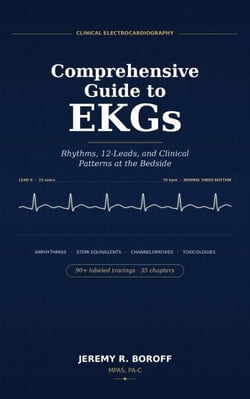 Comprehensive Guide to EKG's  Rhythms, 12 leads, and Clinical Patterns at Bedside