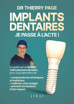 Implants dentaires : je passe à l'acte ! - Le guide qui va faciliter votre parcours de soins, vous permettre de comprendre les techniques et matériaux afin de maîtriser votre budget, prévenir les douleurs et les risques