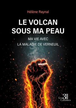 Le volcan sous ma peau - Ma vie avec la maladie de Verneuil