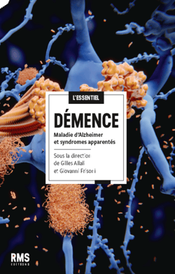 Démence - L'essentiel