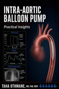 Intra-Aortic Balloon Pump: Practical Insights - Medical Series