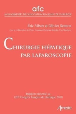 Chirurgie hépatique par laparoscopie