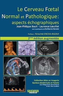 Le cerveau fœtal normal et pathologique