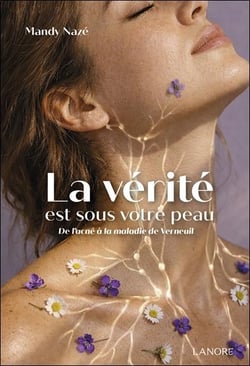La vérité est sous votre peau ! De l'acné à la maladie de Verneuil