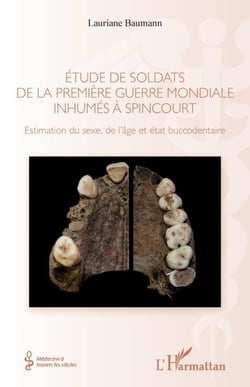 Étude de soldats de la première guerre mondiale inhumés à Spincourt - Estimation du sexe, de l'âge et état buccodentaire