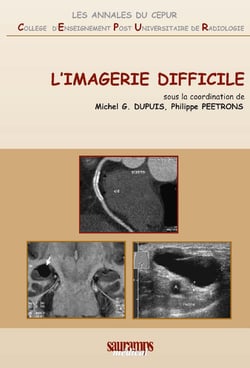 L'imagerie difficile