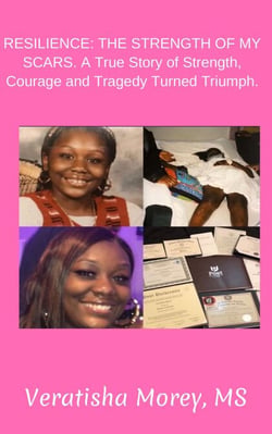 Resilience: The Strength of My Scars, a True Story of Strength, Courage and Tragedy Turned Triumph.