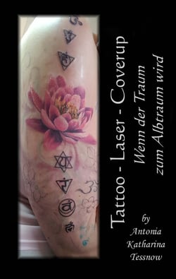 Tattoo - Laser - Cover Up - Wenn der Traum zum Albtraum wird