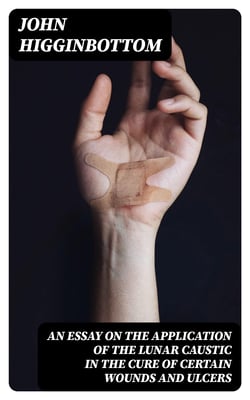 An Essay on the Application of the Lunar Caustic in the Cure of Certain Wounds and Ulcers