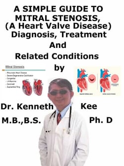 A  Simple  Guide to  Mitral Stenosis (A Heart Valve Disease),  Diagnosis, Treatment  and  Related Conditions
