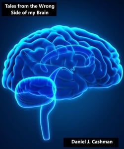 Tales from the Wrong Side of my Brain