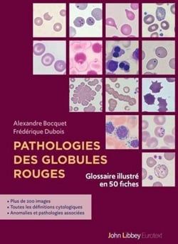 Pathologies des globules rouges - Glossaire illustré en 50 fiches