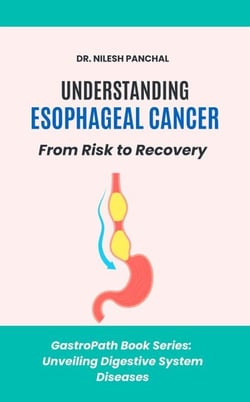 Understanding Esophageal Cancer: From Risk to Recovery - GastroPath: Unveiling Digestive System Diseases, #6