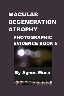 Macular Degeneration, Photographic Evidence Book 8 - Macular Degeneration Atrophy, Photographic Evidence Series of   Books, #11