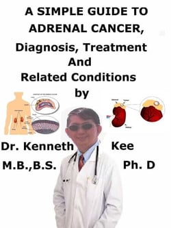 A  Simple  Guide  to  Adrenal Cancer,  Diagnosis, Treatment and  Related Conditions