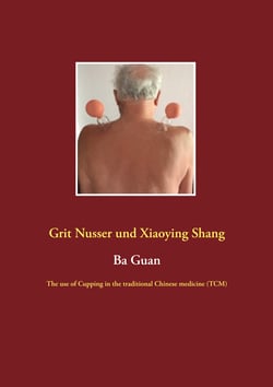 Ba Guan - The use of Cupping in the traditional Chinese medicine (TCM)