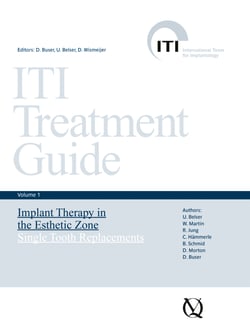 Implant Therapy in the Esthetic Zone - Single-Tooth Replacements