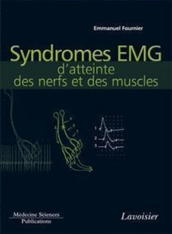 Syndromes EMG d'atteinte des nerfs et des muscles