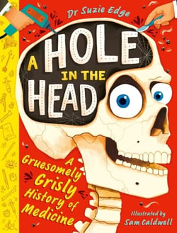 A Hole in the Head - A gruesomely grisly history of medical firsts