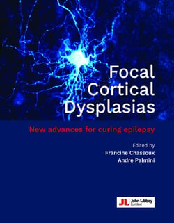 Focal Cortical Dysplasias - New advances for curing epilepsy