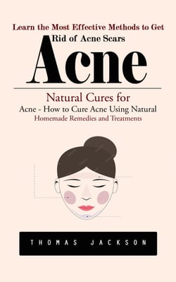 Acne: Learn the Most Effective Methods to Get Rid of Acne Scars (Natural Cures for Acne - How to Cure Acne Using Natural Homemade Remedies and Treatments)