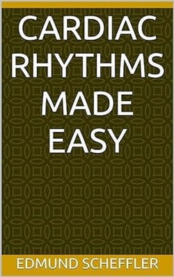 Cardiac Rhythms Made Easy For Nurses