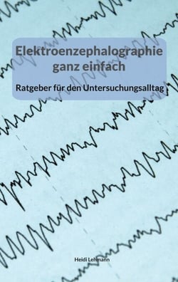 Elektroenzephalographie ganz einfach - Ein Ratgeber für den Untersuchungsalltag