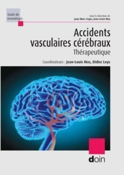 Accidents vasculaires cérébraux - Thérapeutique