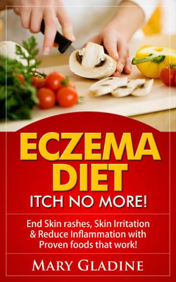 Eczema Diet: Itch No More! End Skin rashes, skin irritation &amp; reduce inflammation with A Low Inflammation Diet &amp; Proven foods that work! BONUS know what to avoid!