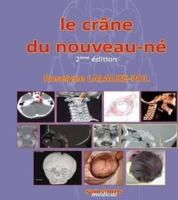 Le crâne du nouveau-né - 2e édition