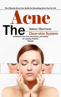 Acne: The Ultimate Acne Cure Guide for Becoming Acne Free for Life (The Clear-skin System to Balance Your Gut, Hormones, and Habits for Lasting, Radiant Results)