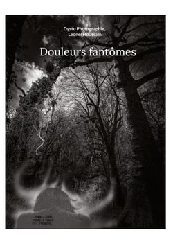 Douleurs fantômes