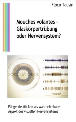 Mouches volantes - Glaskörpertrübung oder Nervensystem? - Fliegende Mücken als wahrnehmbarer Aspekt des visuellen Nervensystems