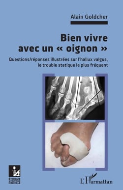 Bien vivre avec un "oignon" - Questions/réponses illsutrées sur l'hallux valgus, le trouble statique le plus fréquent