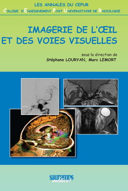 Imagerie de l'œil et des voies visuelles