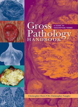 Gross Pathology Handbook - A Guide to Descriptive Terms