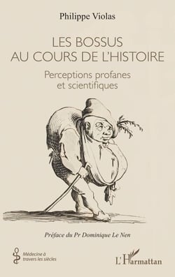 Les bossus au cours de l'histoire - Perceptions profanes et scientifiques