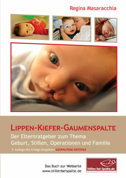 Lippen-Kiefer-Gaumenspalte - Gespaltene Gefühle: 3. Auflage