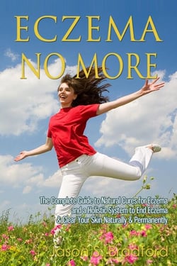 Eczema No More: The Complete Guide to Natural Cures for Eczema and a Holistic System to End Eczema &amp; Clear Your Skin Naturally &amp; Permanently