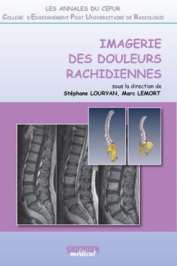 Imagerie des douleurs rachidiennes