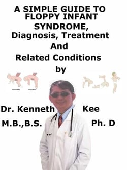A  Simple  Guide  to  Floppy Infant Syndrome,  Diagnosis, Treatment  and  Related Conditions