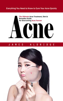 Acne: Everything You Need to Know to Cure Your Acne Quickly (The Ultimate Acne Treatment, Diet &amp; Remedies Guide for Overcoming Acne Forever)